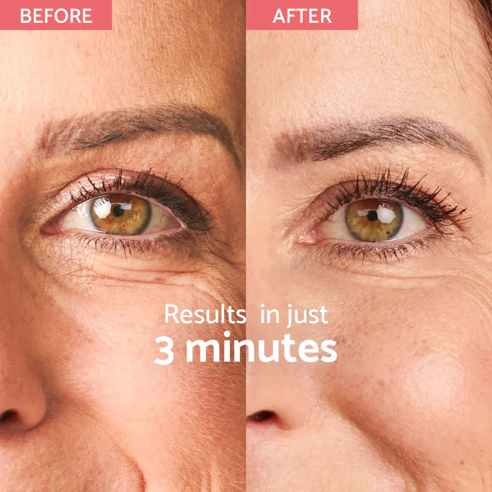 Instant Wrinkle Corrector – коректор за бръчки с мигновен ефект (180 нанасяния)  Remescar - Nutra Best Bulgaria